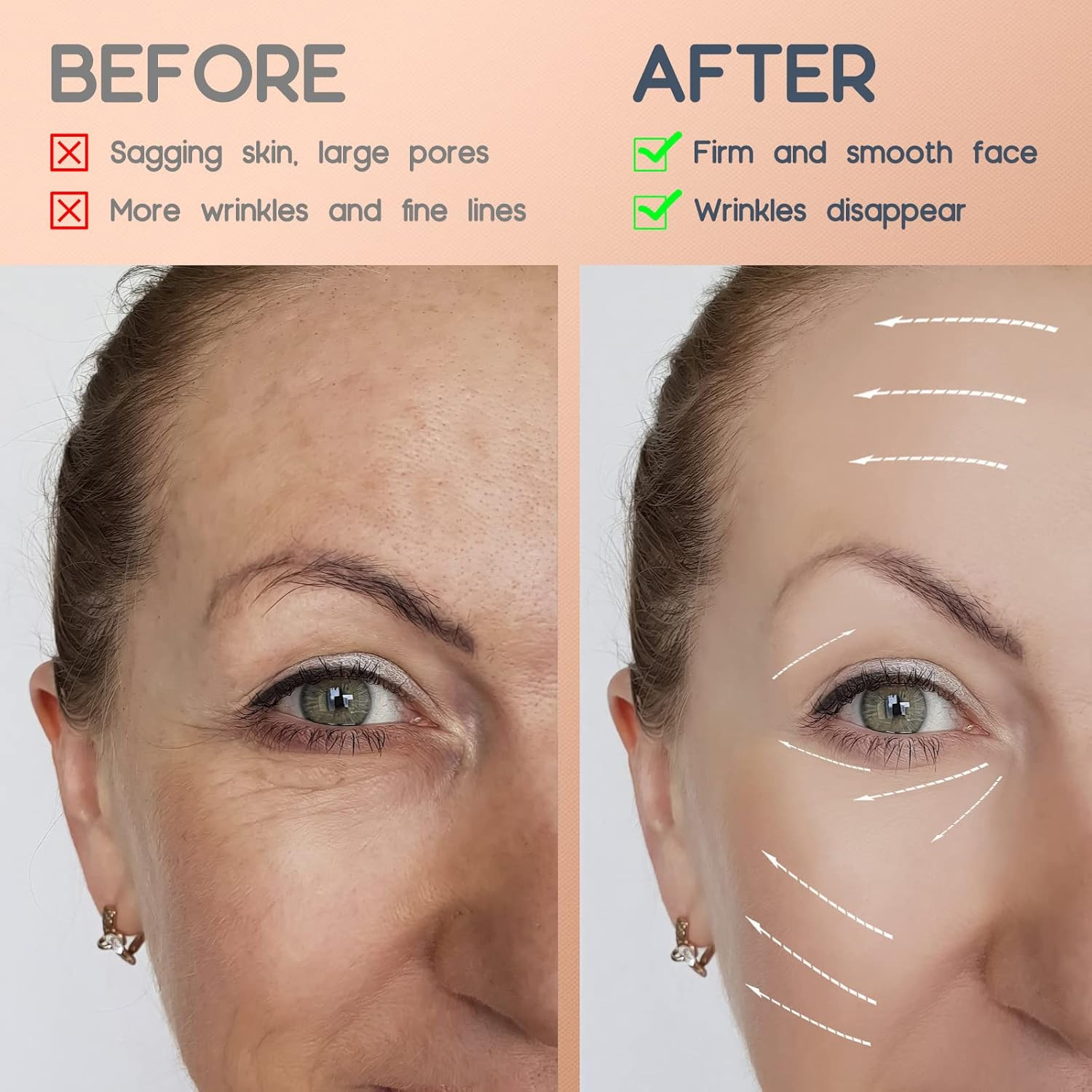 AURUZA 2 Rolls Facial Myofascial Face Lift Tape,Neck & Forehead Smooths Wrinkles