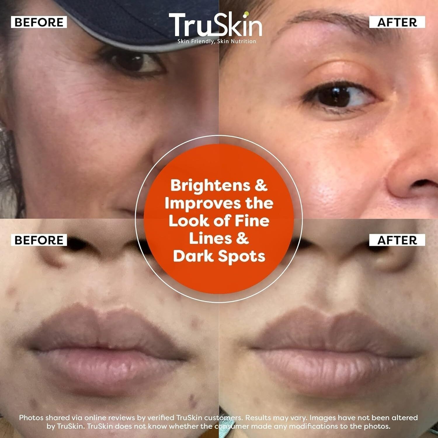 TruSkin Vitamin C Serum For Face – Anti Aging Formula with Vitamin C, Hyaluronic