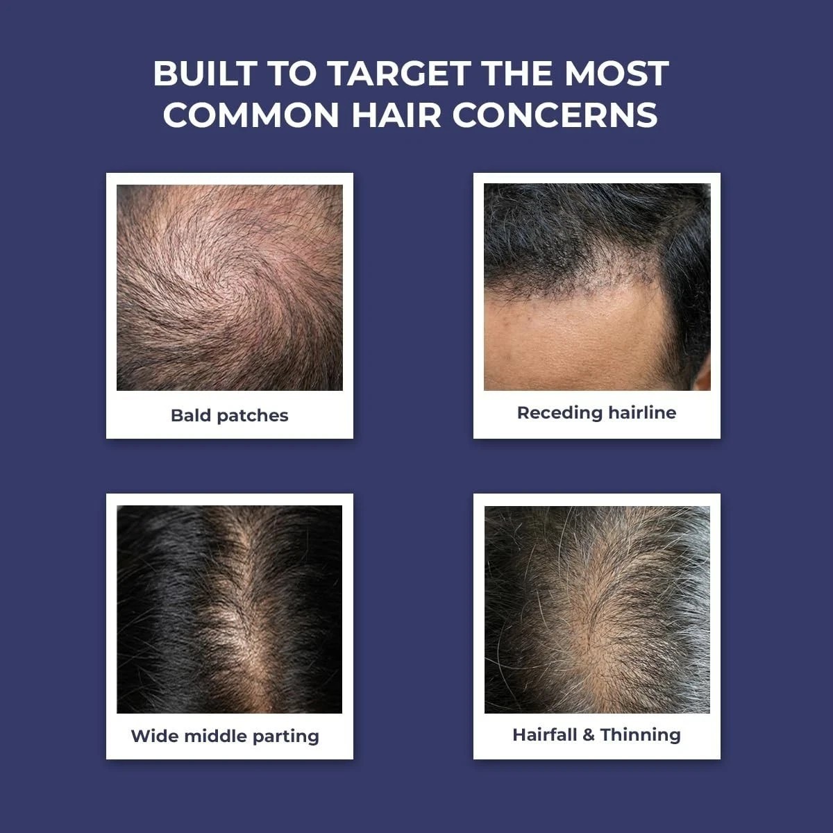 Conscious Chemist® Anti Hairfall Shampoo Rosemary OIl & Keratin 200 ML