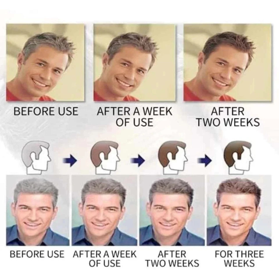 Restoria Discreet Hair Cream 250ml – Grey Hair Reversal & Natural Color Restore