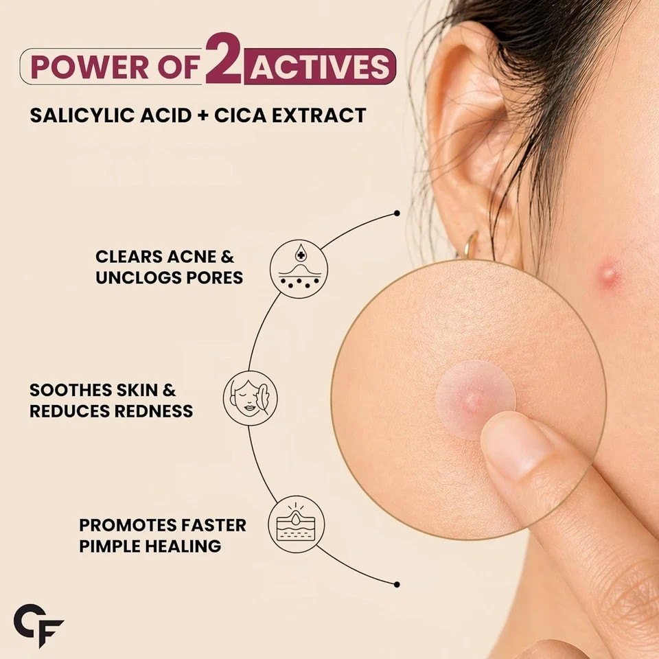Carbamide Forte for Face Salicylic Acid & Cica 72 Hydrocolloid Pimple Patches