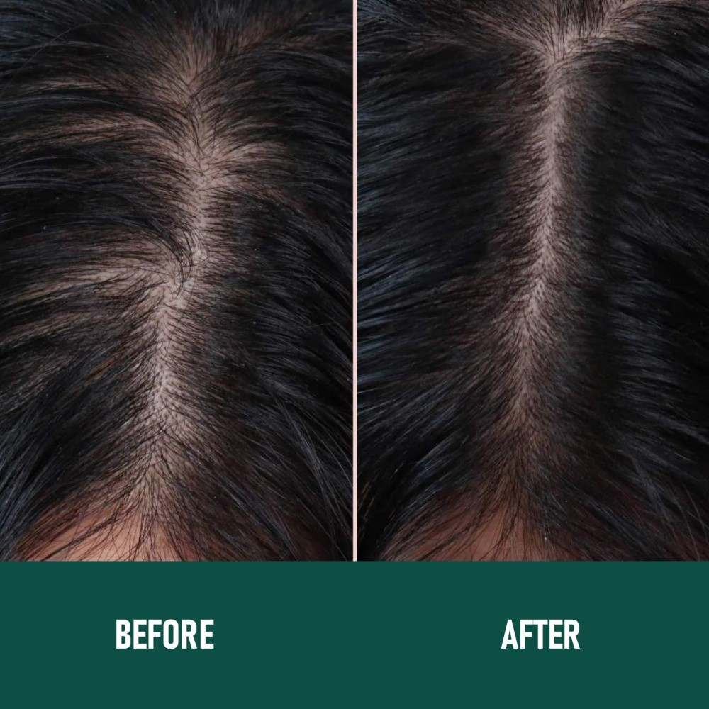 Anti-Hair Loss Mousse Thicker And Fuller Hair