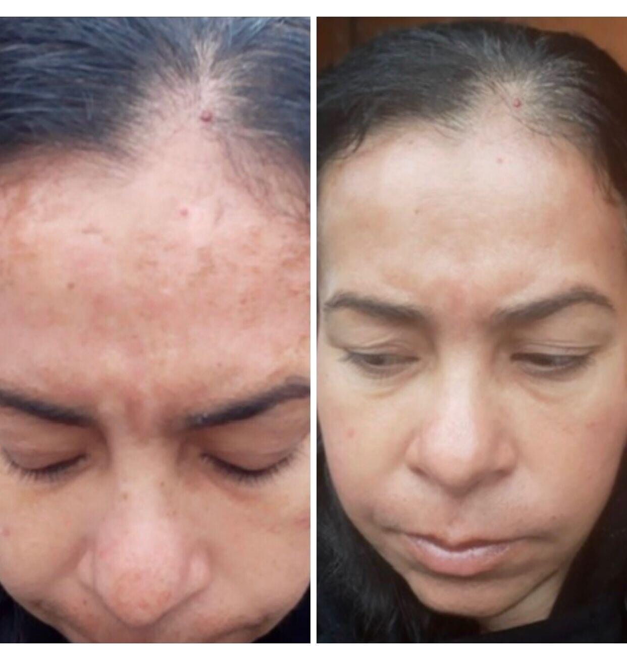 Super Skin Lightener Cream, Eliminan Las Manchas Oscuras Para Piel Clara, 5 oz.