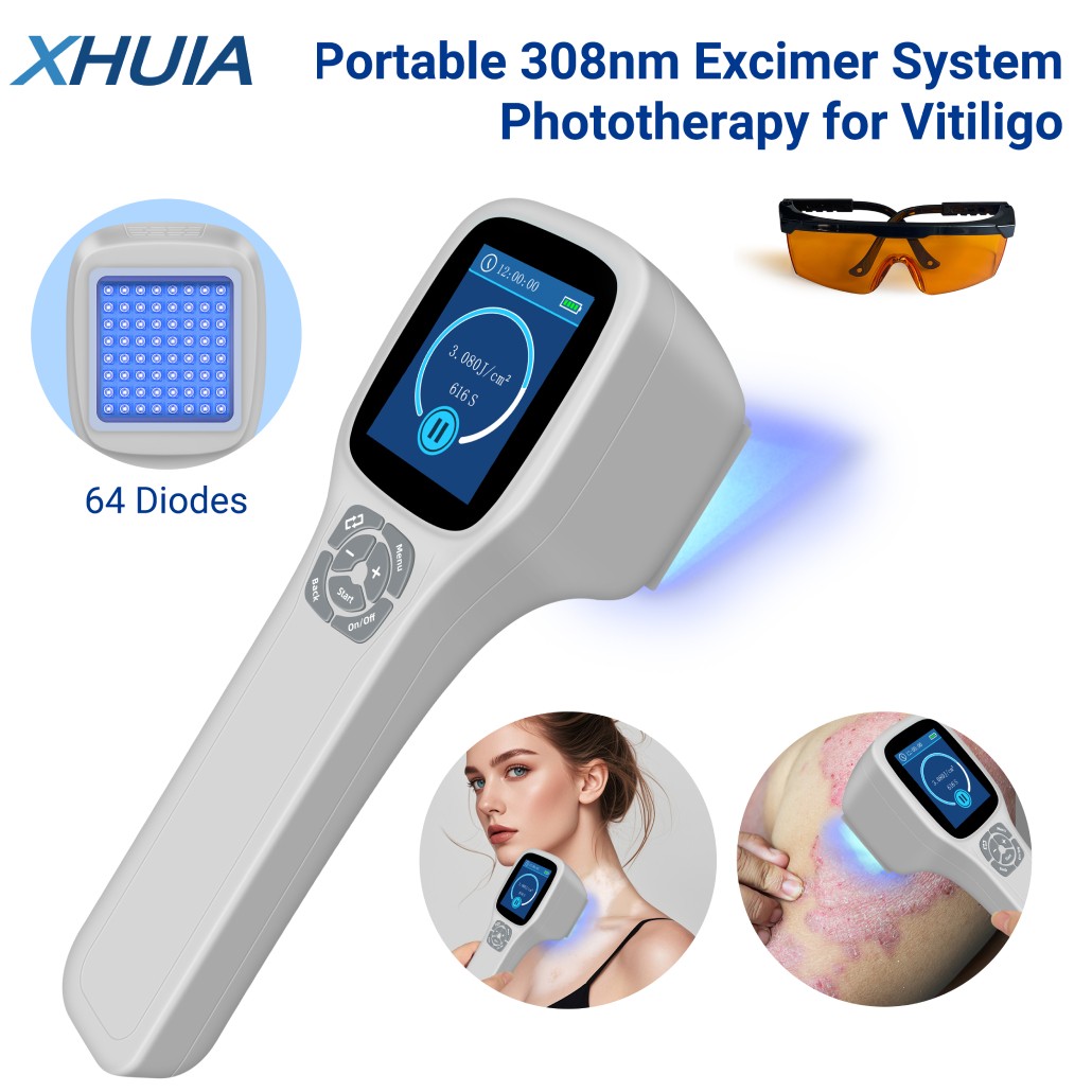 308nm UVB Blue Lamp Phototherapy Device for Skin Diseases Treatment 64 Diodes