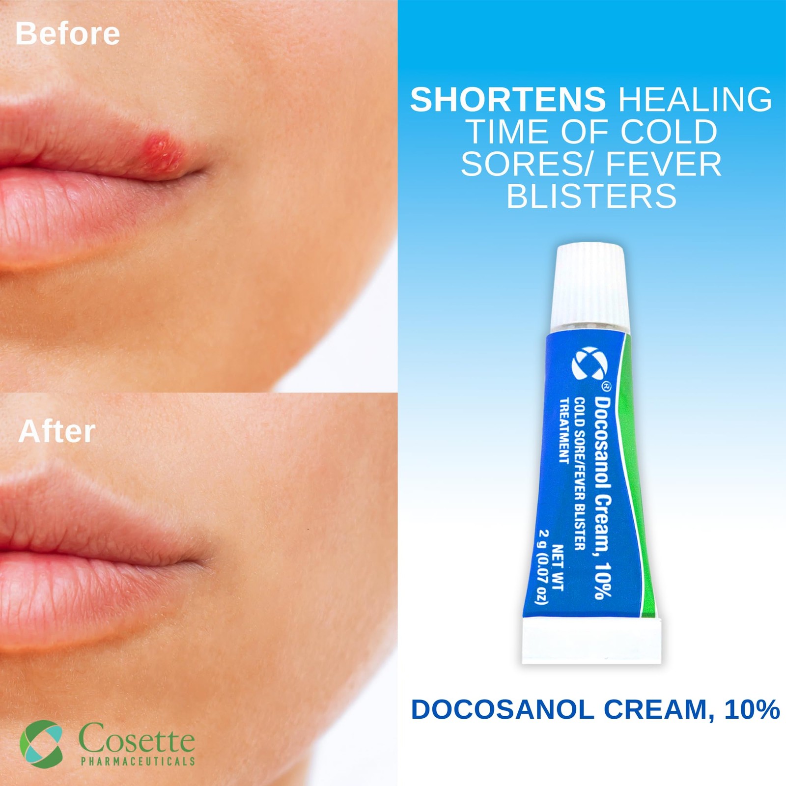 Cosette Pharmaceuticals Cosette Cold Sore/Fever Blister Treatment For Face Or