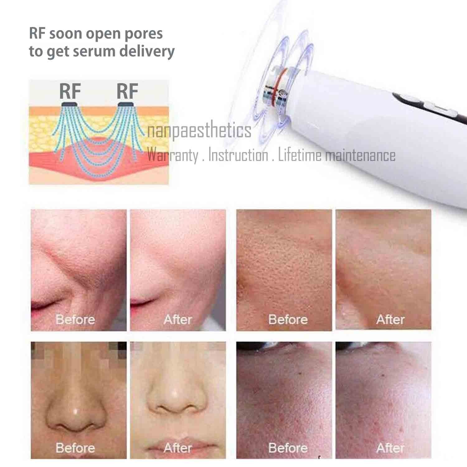 8in1 Hydra Dermabrasion RF Microcurrent Ice Cold Hammer Meso Facial Spa Machine