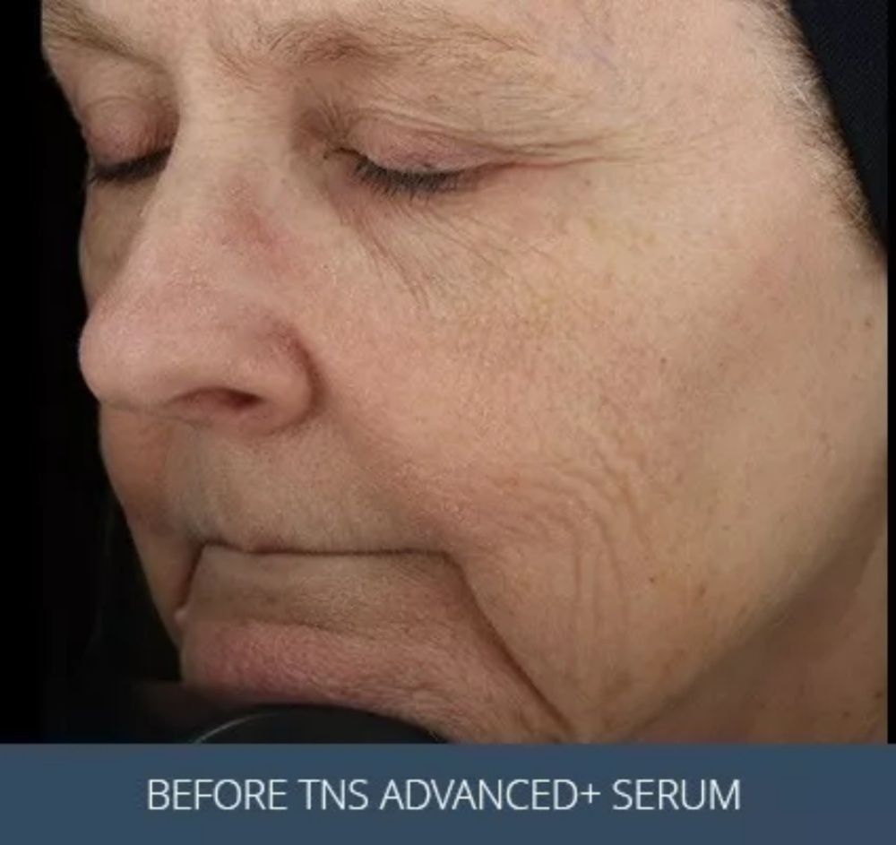 Brand New TNS Advanced + Serum Anti-Aging For All Skin Types 28.4g EXP 10/27