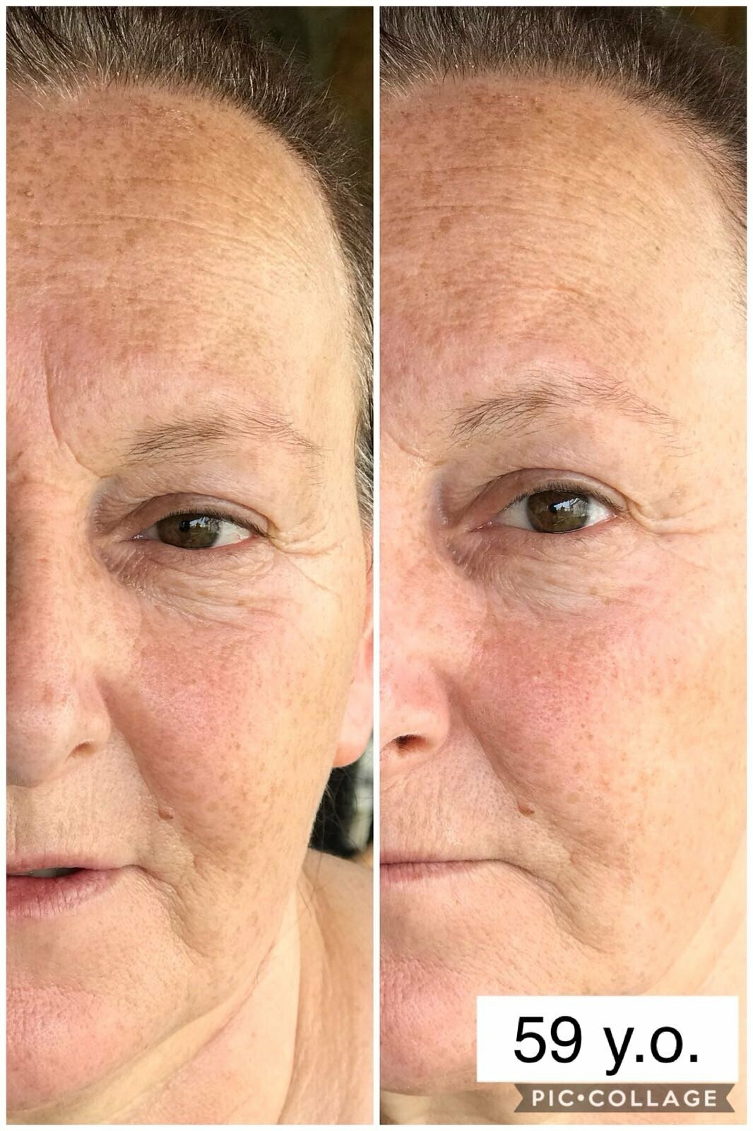 VITAYES Instant Ageback Anti-Aging Facelift Cream (15 ml Tube)