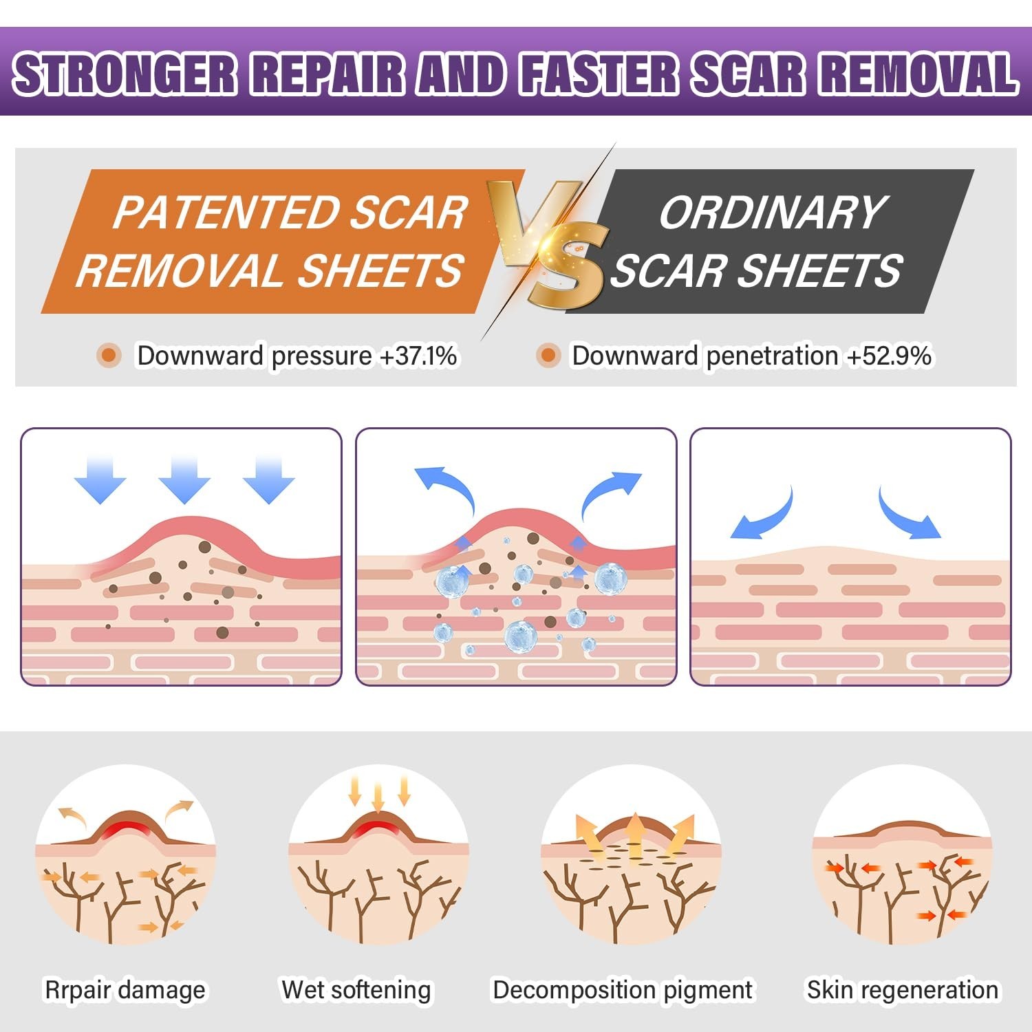 Medical Grade Silicone Scar Tape Sheet Roll 1.6in x 59in Reusable Scar Care