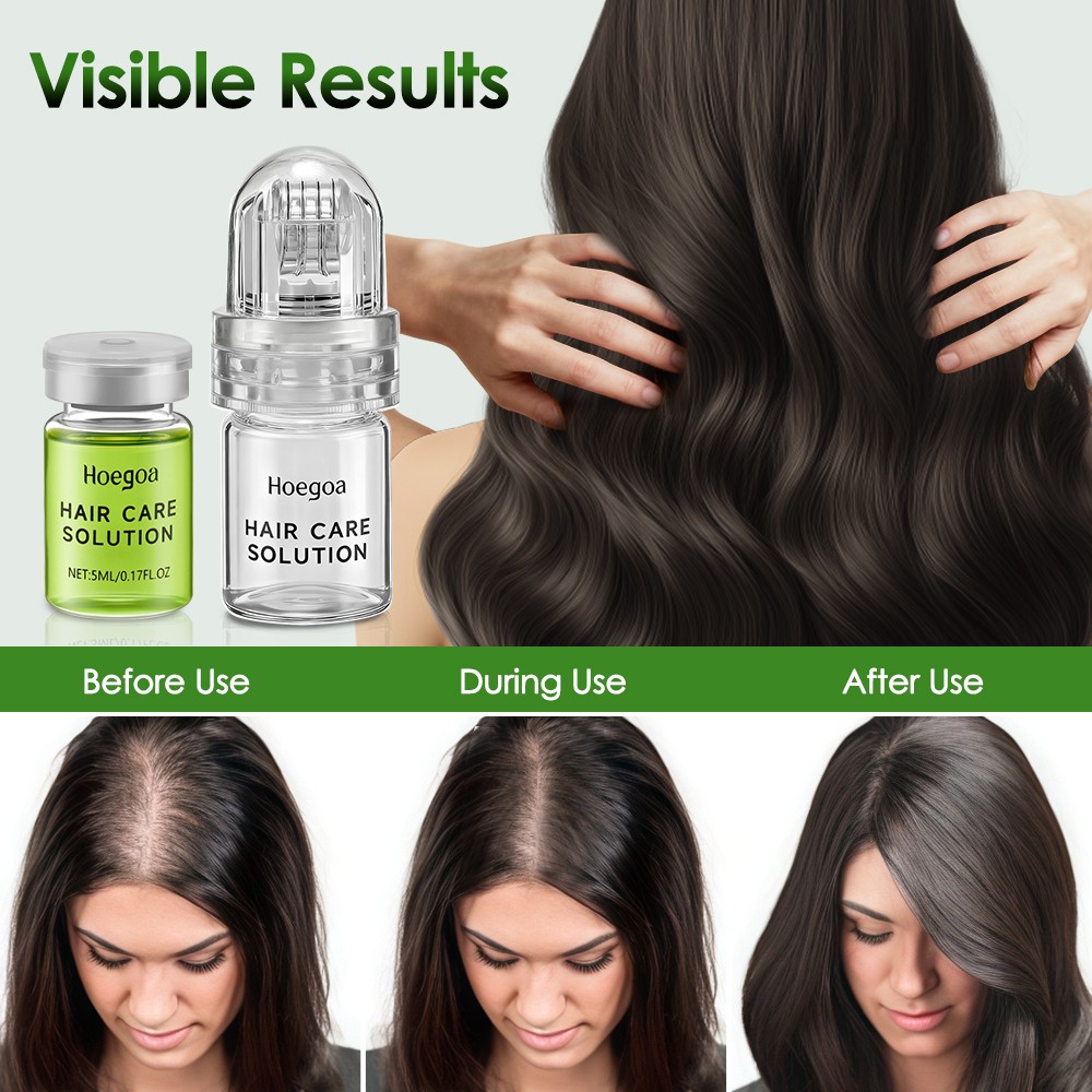 Hair Regrowth System,Advanced Hair Growth Treatment for Men & Women