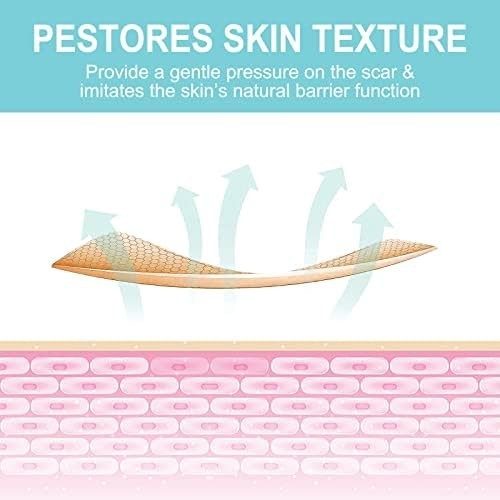 Silicone Scar Tape for Keloids Hypertrophic Scars 1.6in x 150in 3.8m Roll Kit