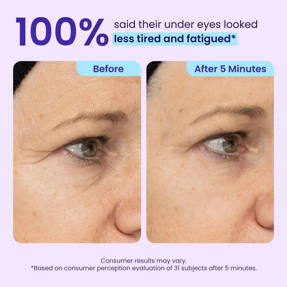 NEW! GOPURE Instant Lift Eye Gel – For Puffiness & Bags, Fine Lines 0.35 Oz