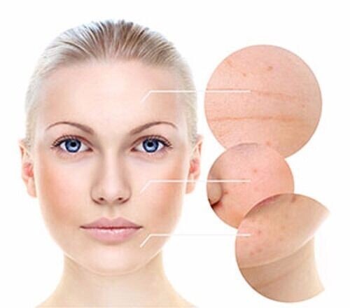 Peptide Collagen Serum AntiAging Wrinkle Cream-Matrixyl 3000 Hyaluronic Acid