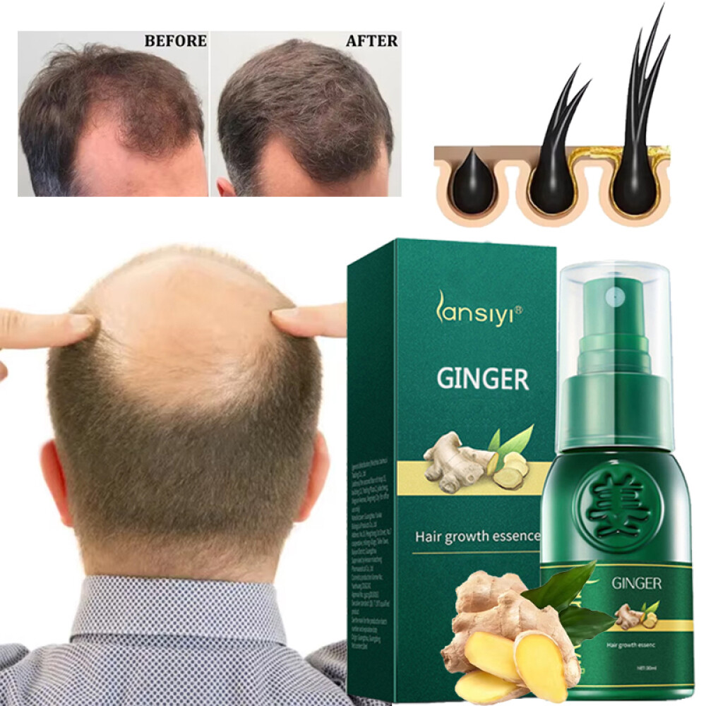 Herbal Ginger Hair Growth Spray Anti Hair Loss Treatment Dense Regrowth Essence.