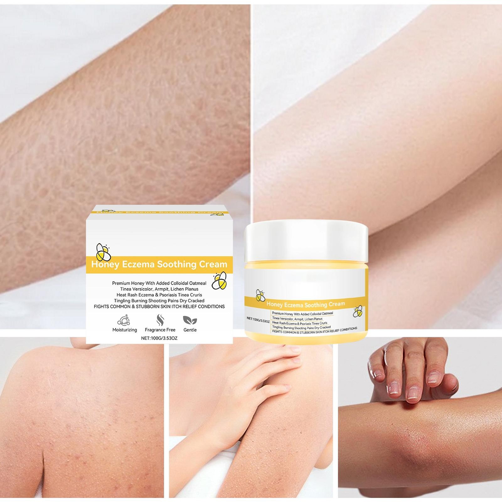 Honey Eczema Soothing Cream Moisturizing Lotion For Dry Itchy Skin Eczema Relief