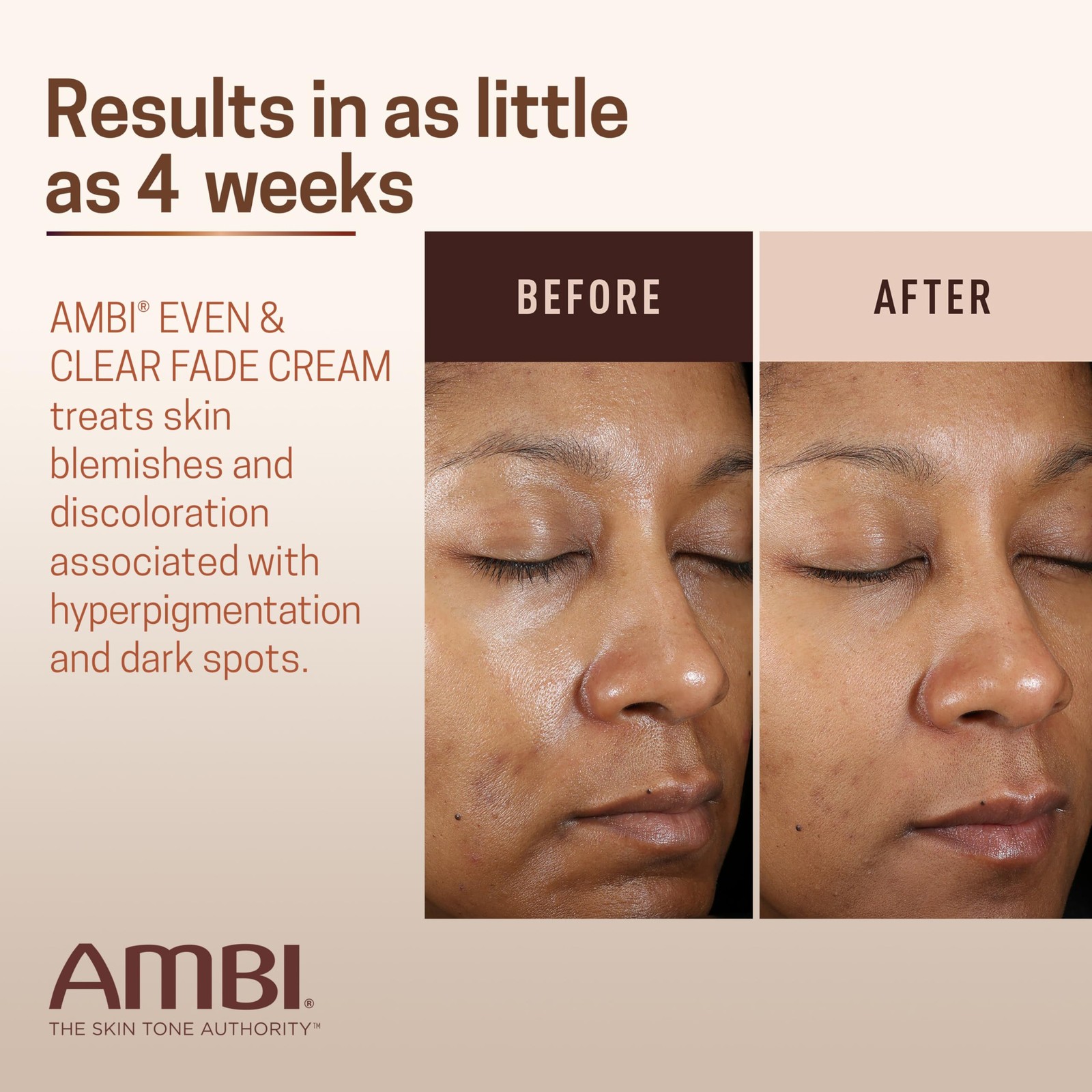 Ambi Even & Clear Fade Cream, 1 Ounce (Pack of 1), No Color