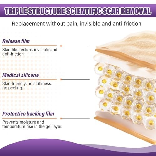 Silicone Scar Tape for Keloids Hypertrophic Scars 1.6in x 150in 3.8m Roll Kit