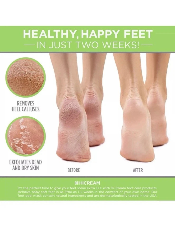 Foot Peel Mask For Baby Soft Feet: Lot Of 2 Boxes (2 Pack Per Box Exp. 01/2025)