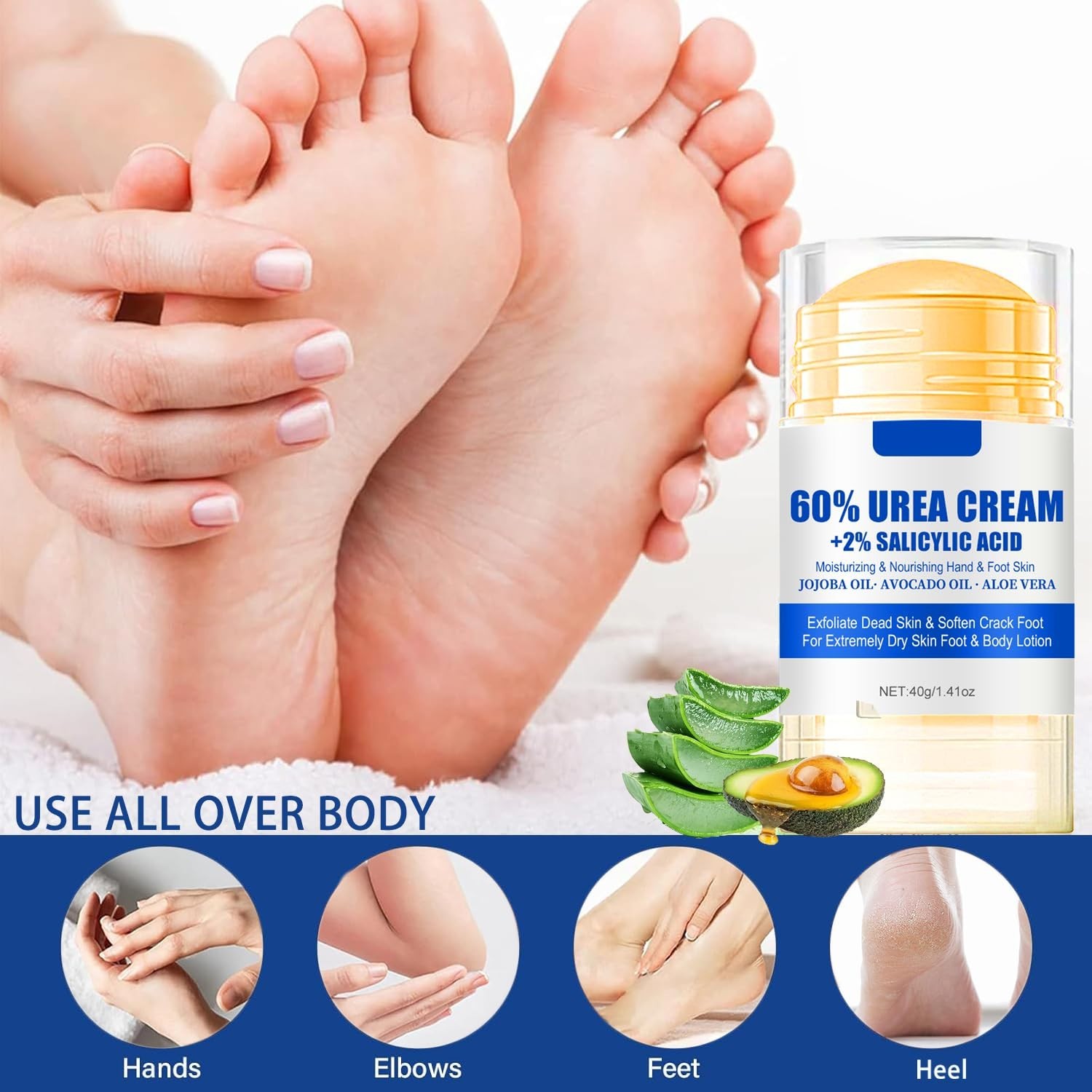 Luxury Urea Cream 60% with 2% Salicylic Acid for Deep Hydration & Softening