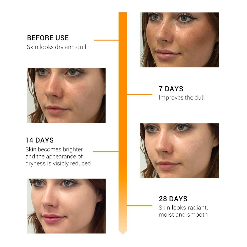 Matrixyl 3000 Peptide Hyaluronic Acid Retinol Collagen Vitamin C Cream AntiAging