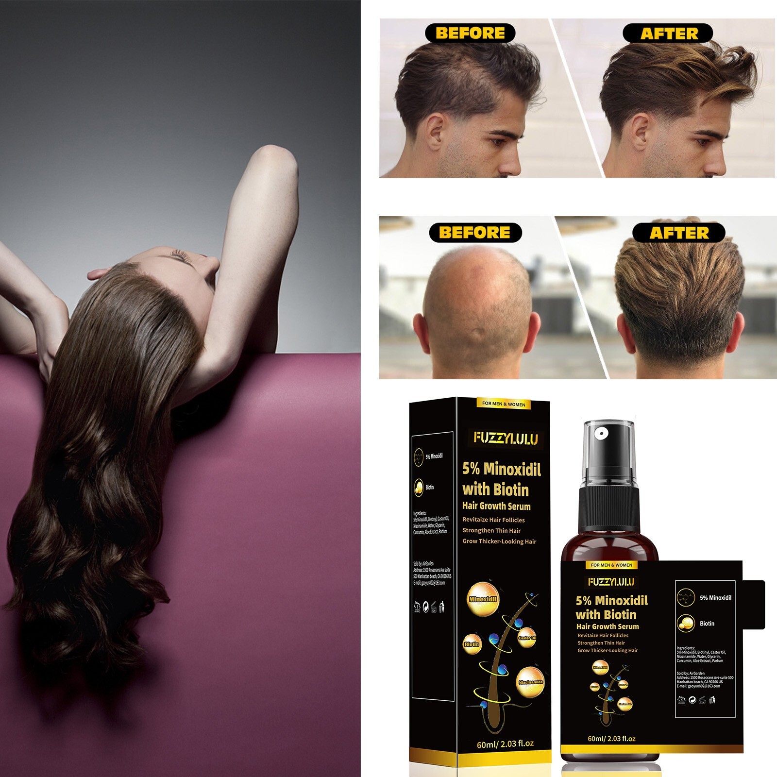 120ml 5% Minoxidil Biotin Hair Growth Serum for Healthier and Thicker Hair