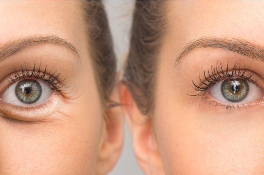 Hyaluronic Acid & Vitamin C Eye Lift Serum Remove Crows Feet Bags Firm AntiAging