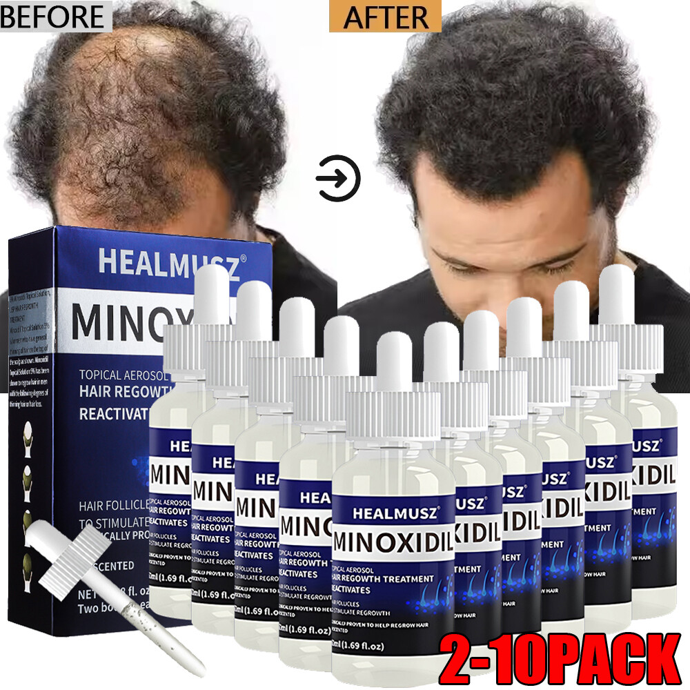 Minoxidil 5% Hair Regrowth Solution Extra Strength Men Women 2-10 Months Supply