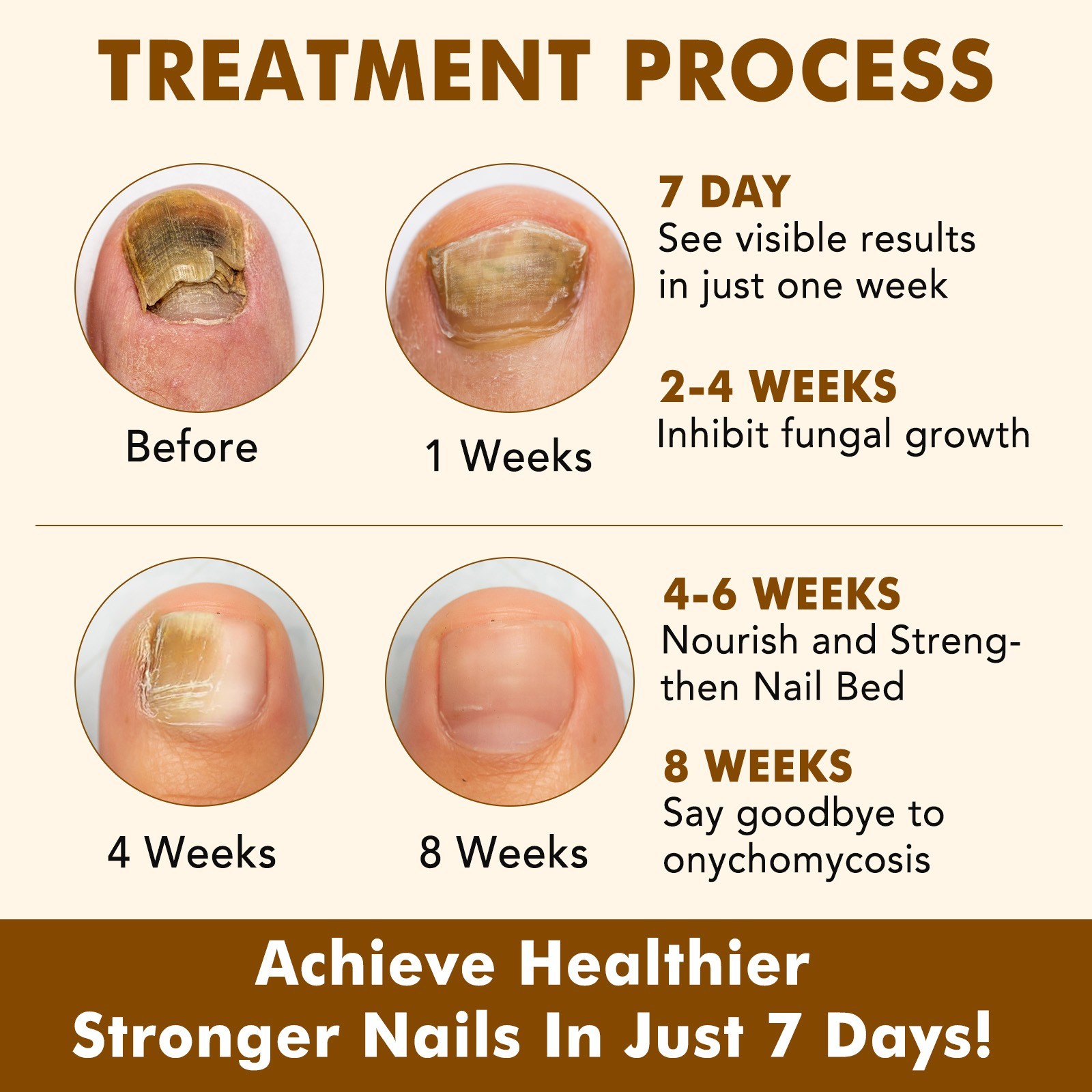 7 Days Nail Fungus Treatment – Extra Strength Repair for Nails & Cuticles 60ML