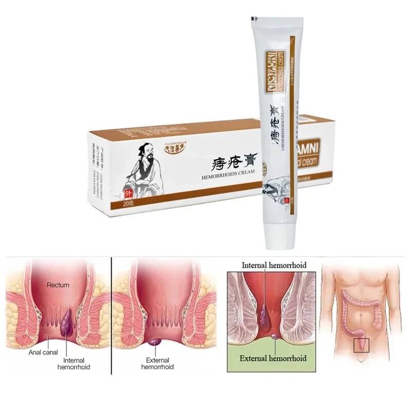 Hemorrhoids Remove Ointment Herbal Cream Relief Piles Pain Reduce Itching SALE