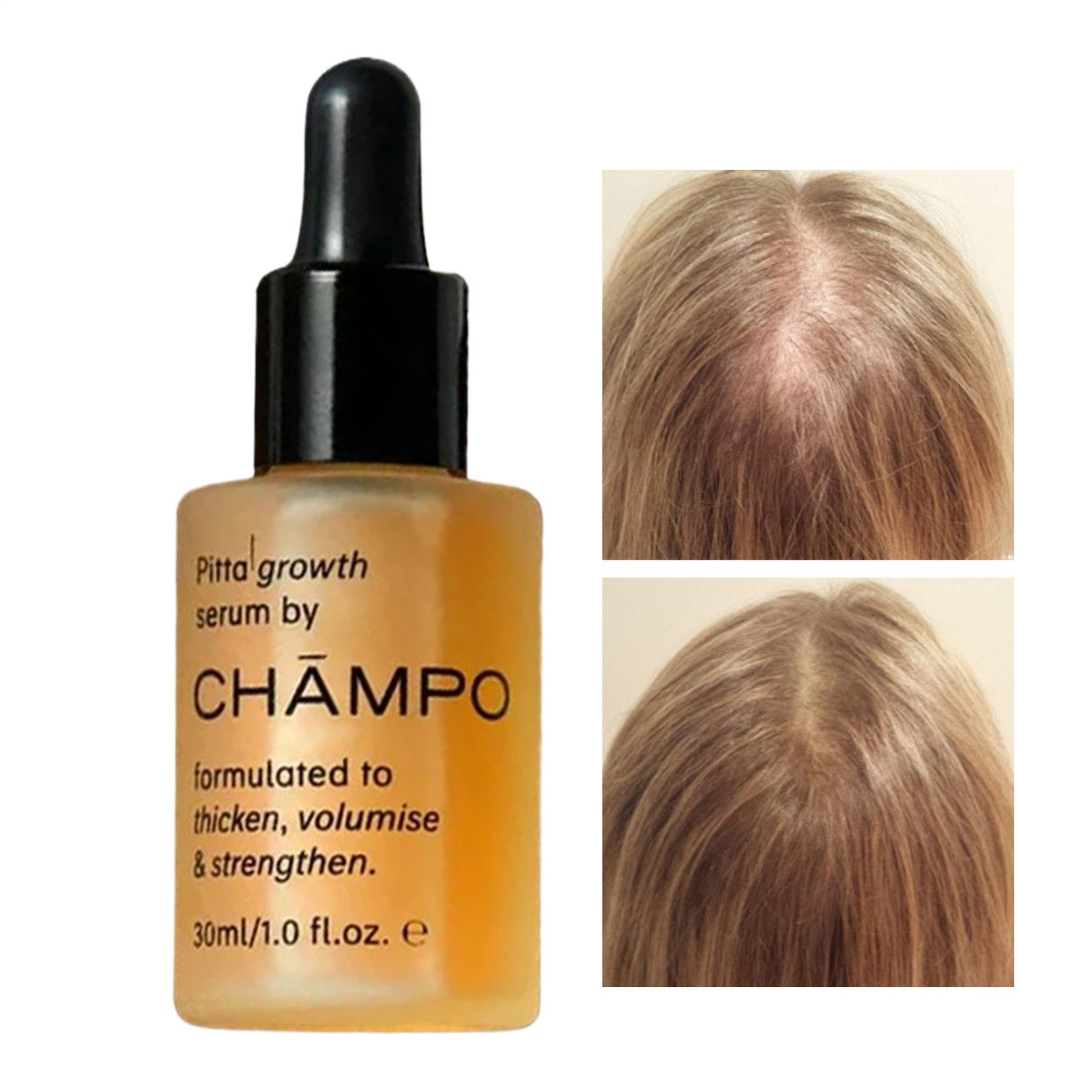 Champo Pitta Growth Serum Formulated To Thicken,Volumise&Strengthen Hair 30ml