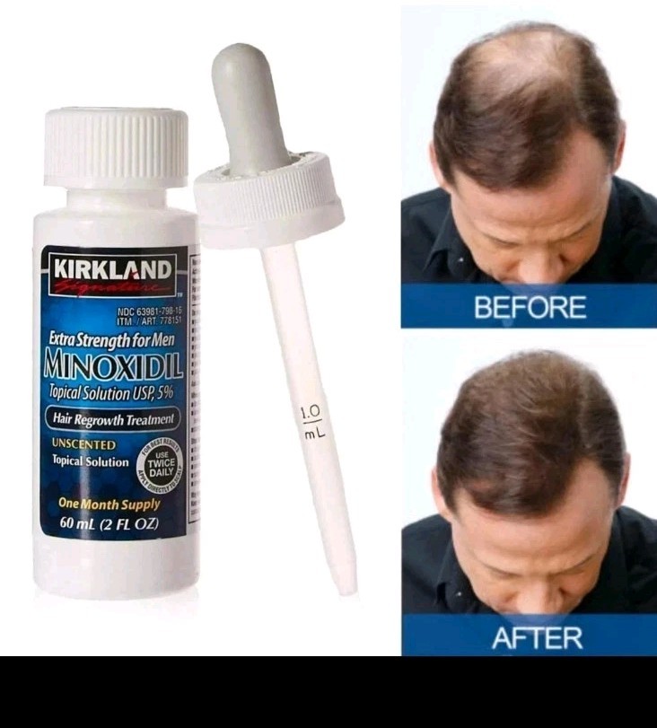 Kirkland Minoxidil 5% Hair Regrowth Treatment 6 Month Supply 6x 2oz NEW SEALED