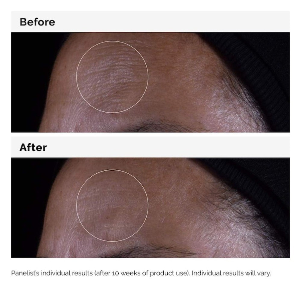 The Ordinary Authentic Serum for Visible Skin Repair and Wrinkles 1 oz / 30 mL