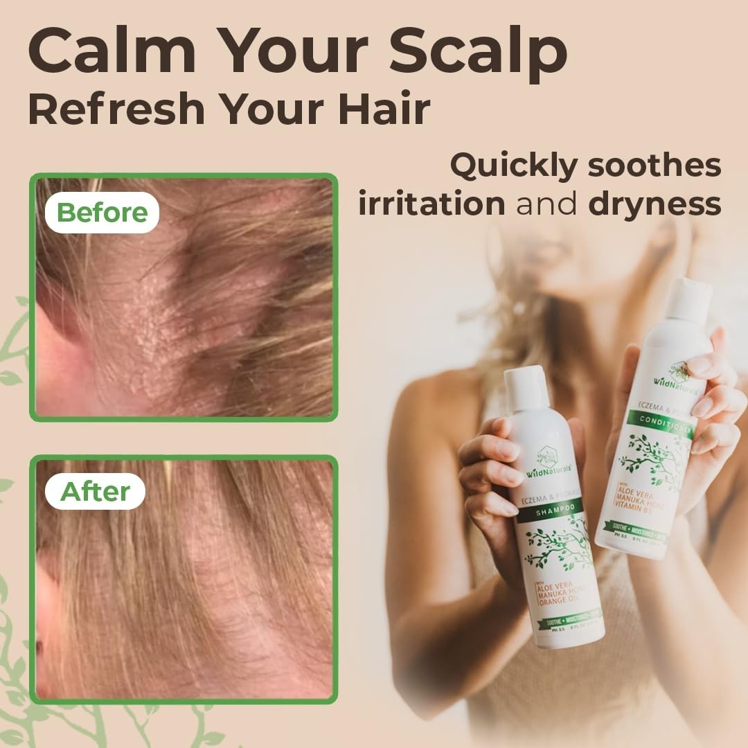 Eczema & Psoriasis Shampoo & Conditioner Set – Hydrate Dry Scalp & Hair