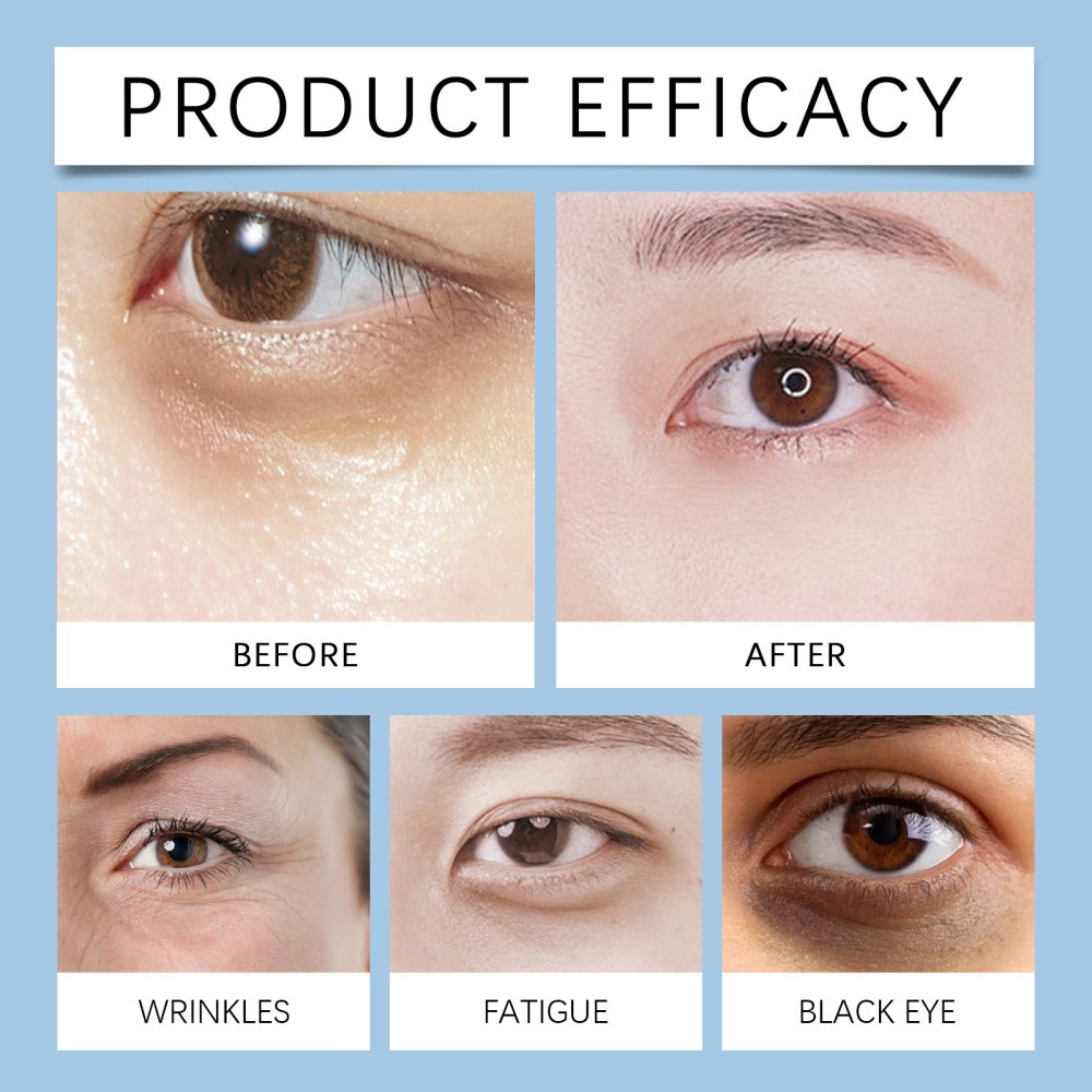 3Pack Firming Eye Serum for Rapid Reduces Under-Eye Bags, Wrinkles, Dark Circles
