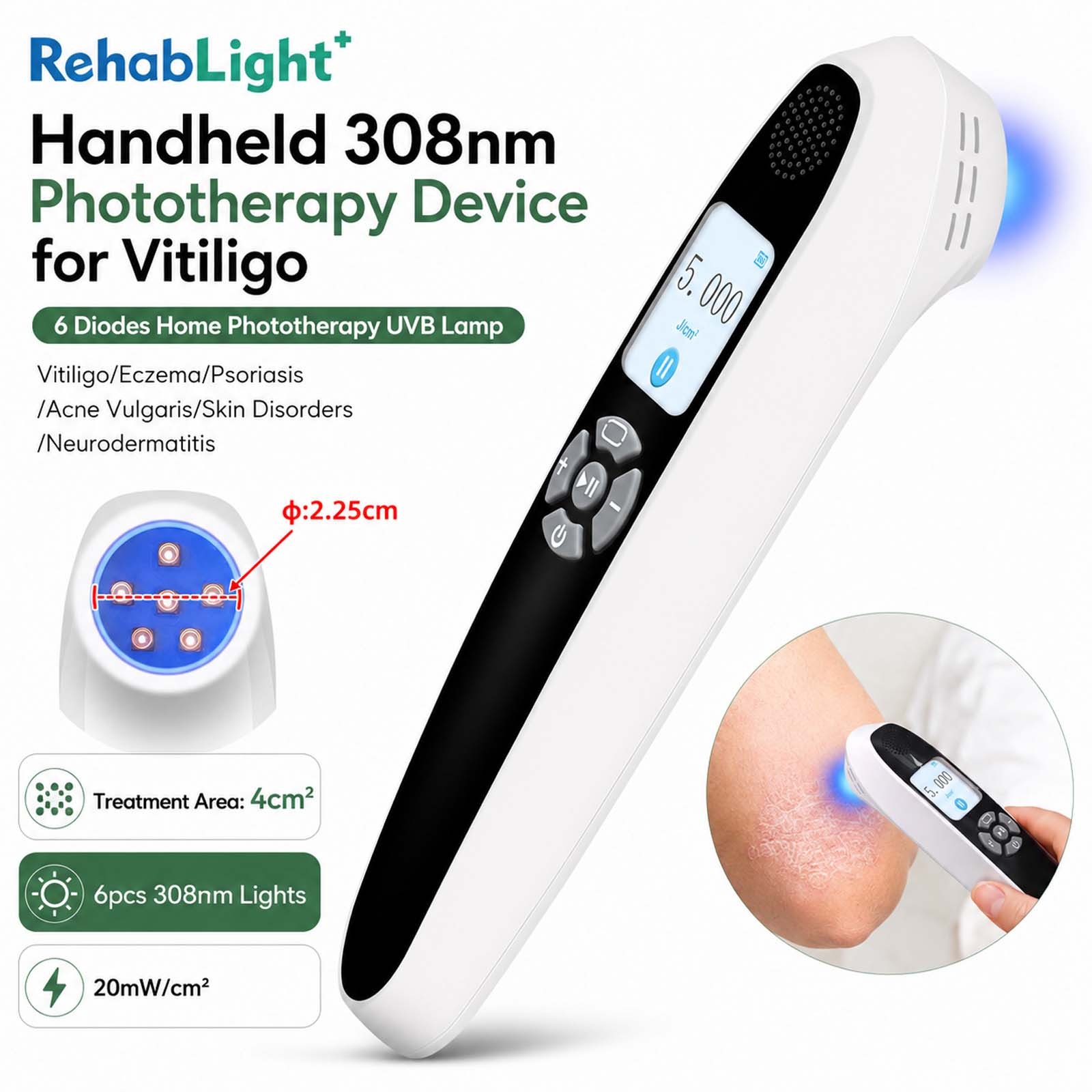 308nm Excimer Lamp UVB Light Therapy Unit 6 Diodes 20mW/cm2 Rechargeable Home