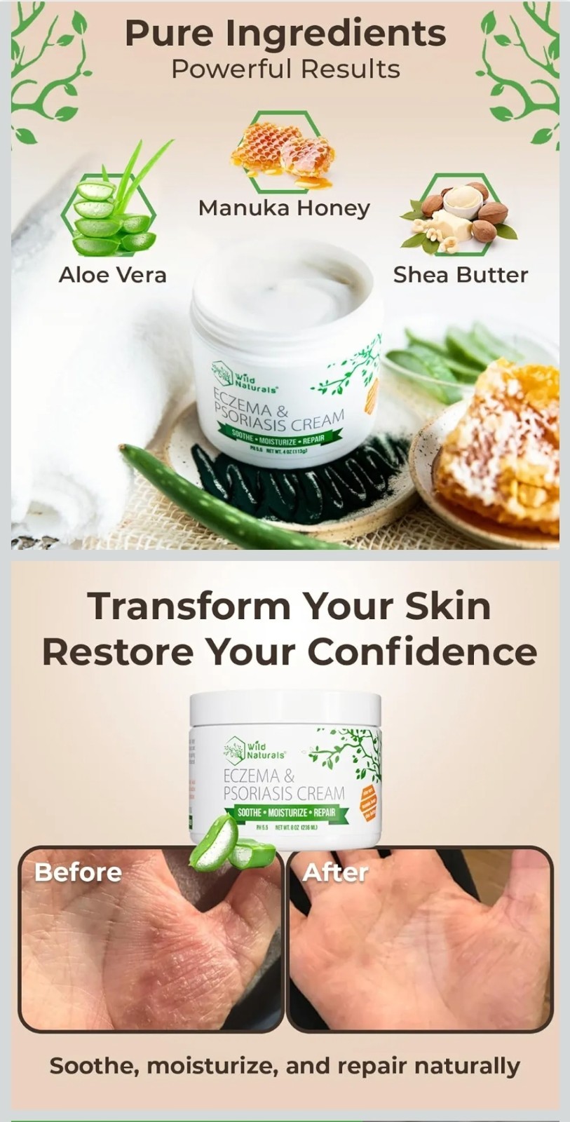 Wild Naturals Eczema & Psoriasis Cream Steroid-Free, Non-Greasy 4 oz Face/Body