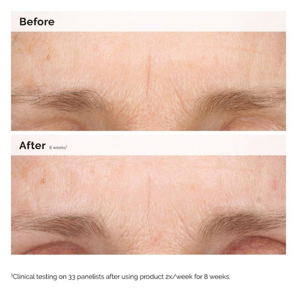 The Ordinary Authentic Retinal 0.2% Emulsion High-Strength Retinoid 0.5 oz