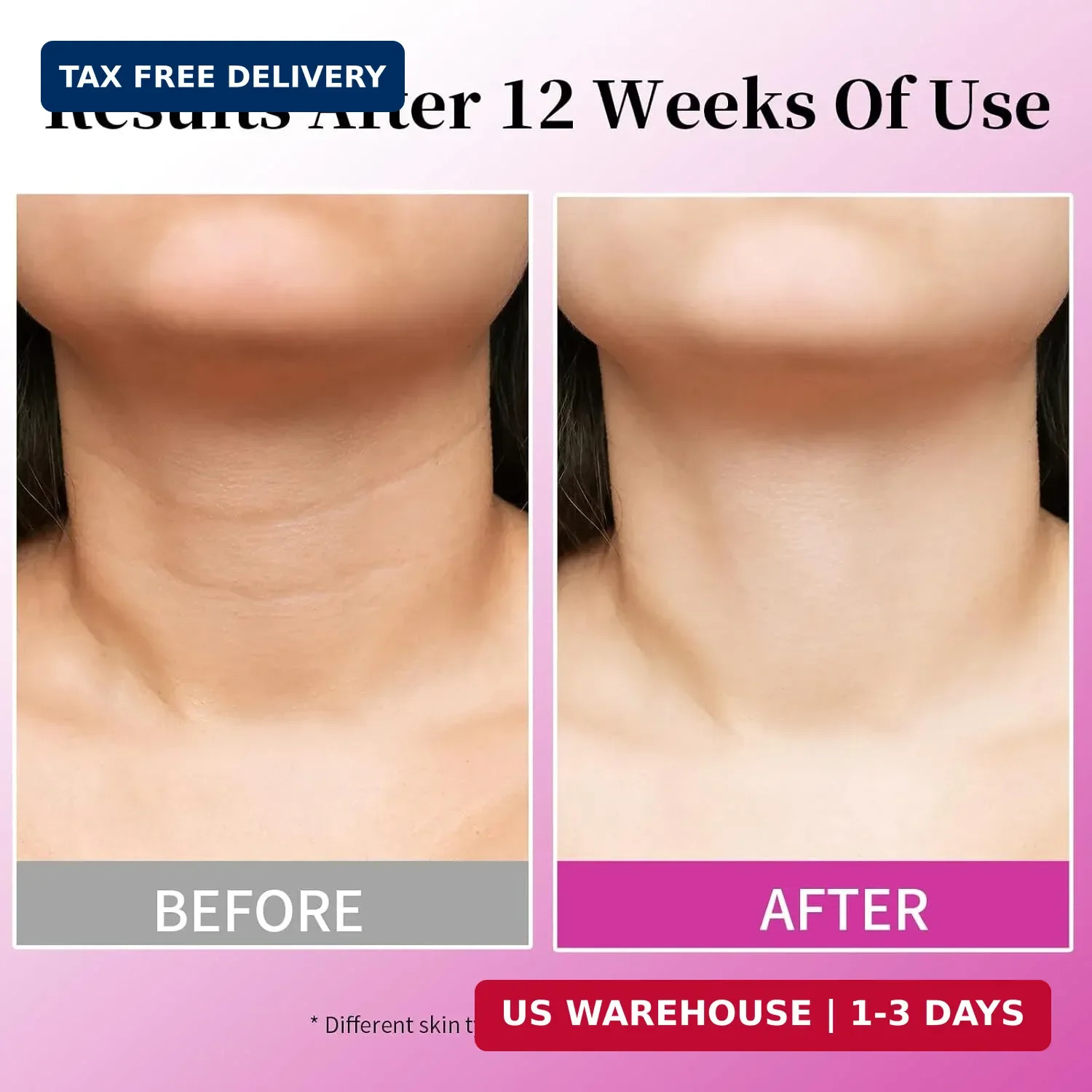 MRLILEI Tightening & Lifting Neck Cream, Advanced Anti-Aging Face Moisturizer, 4