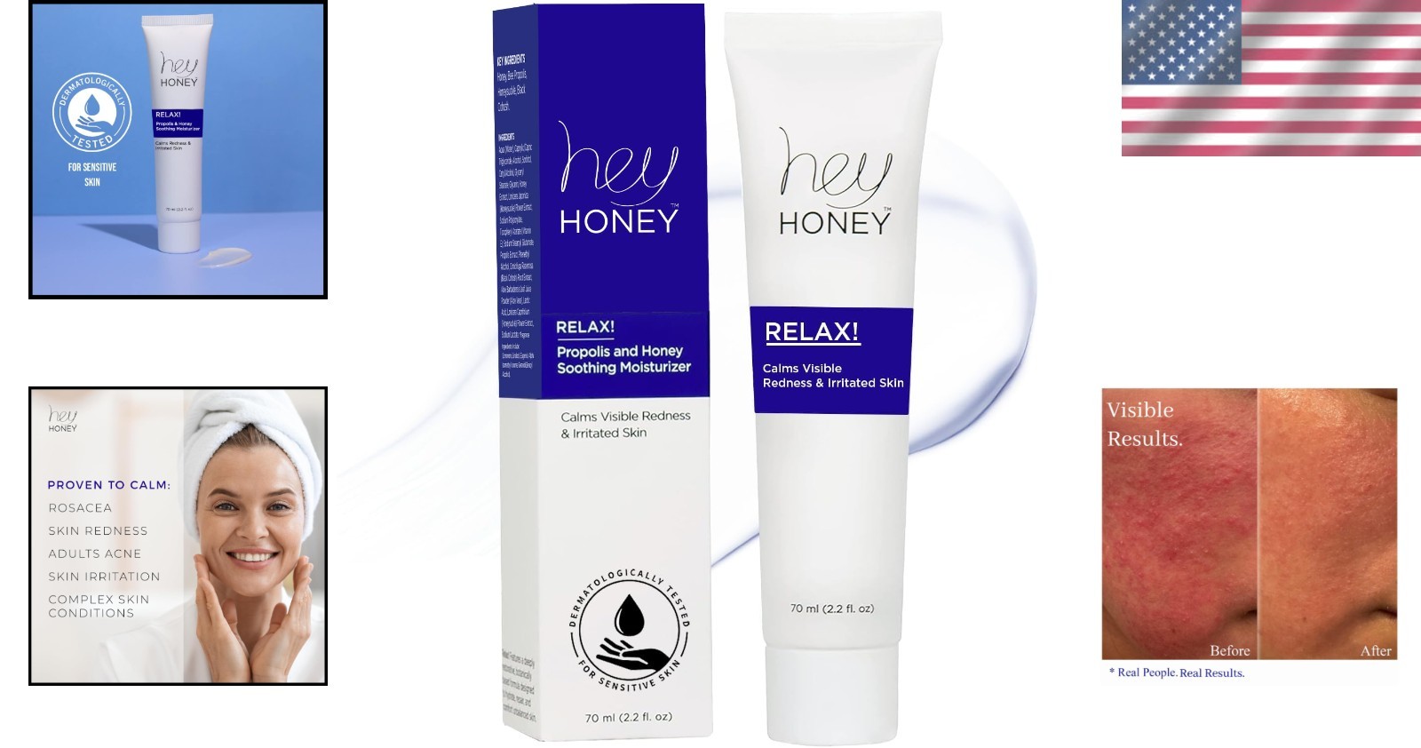 Dermatologist-Tested Rosacea Cream – Hydrating Relief for Facial Redness