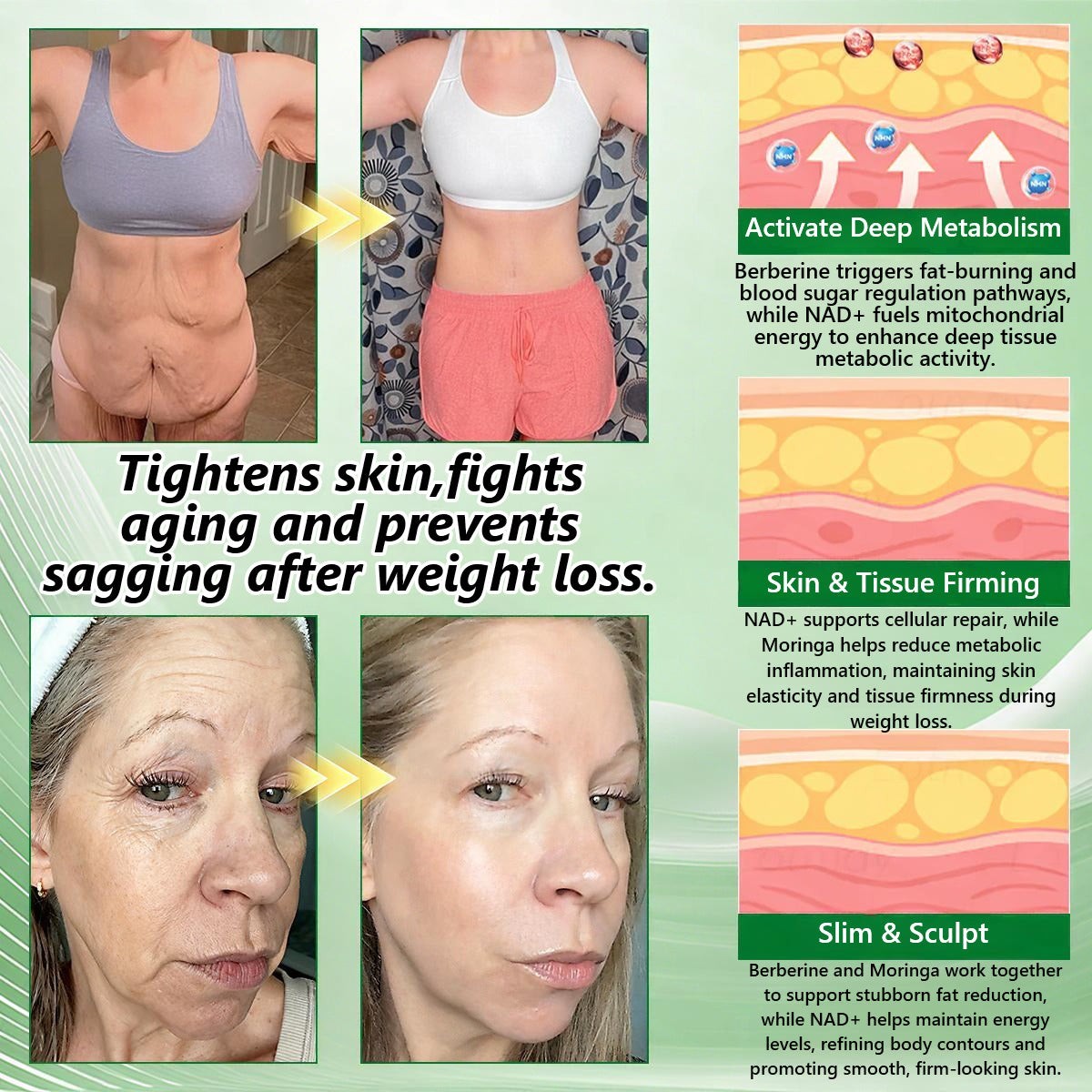 CareUplift Berberine Moringa Metabolic Patch | Nano Microneedle | 7-Day Results