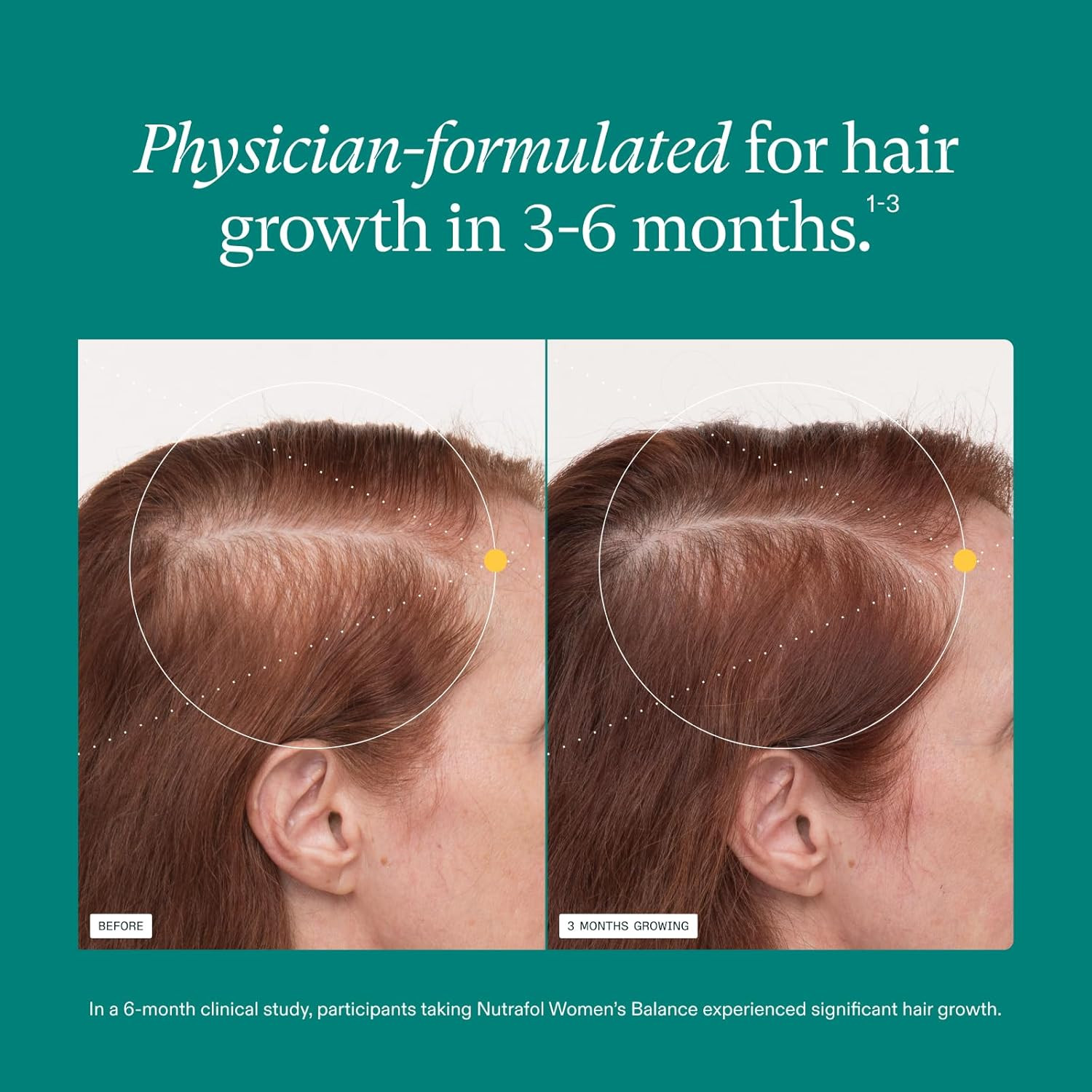 Nutrafol Women’S Balance Hair Growth Supplements, Ages 45 and Up, Clinically Pro