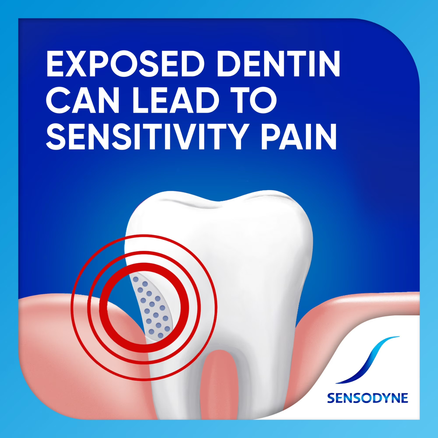 2 Pack Sensodyne Extra Whitening Sensitive Toothpaste Mint Flavor Adult 4 Oz