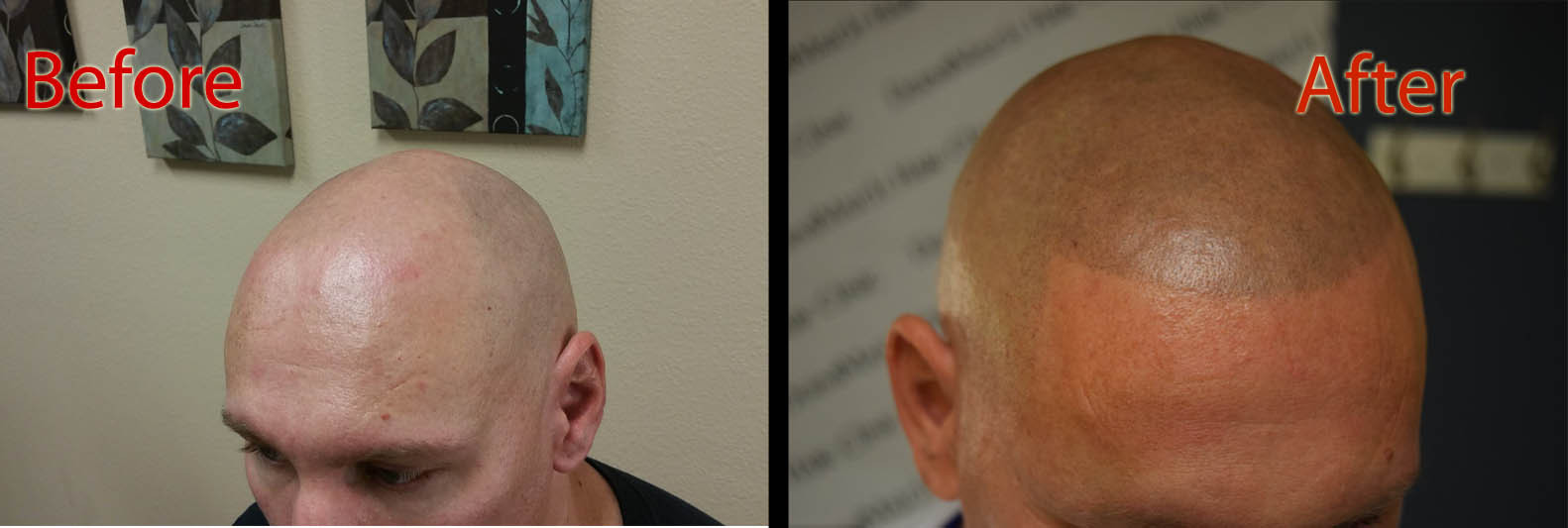 Pigment HD-C – Scalp Micropigmentation Pigment by DermMicro (0.5 oz)
