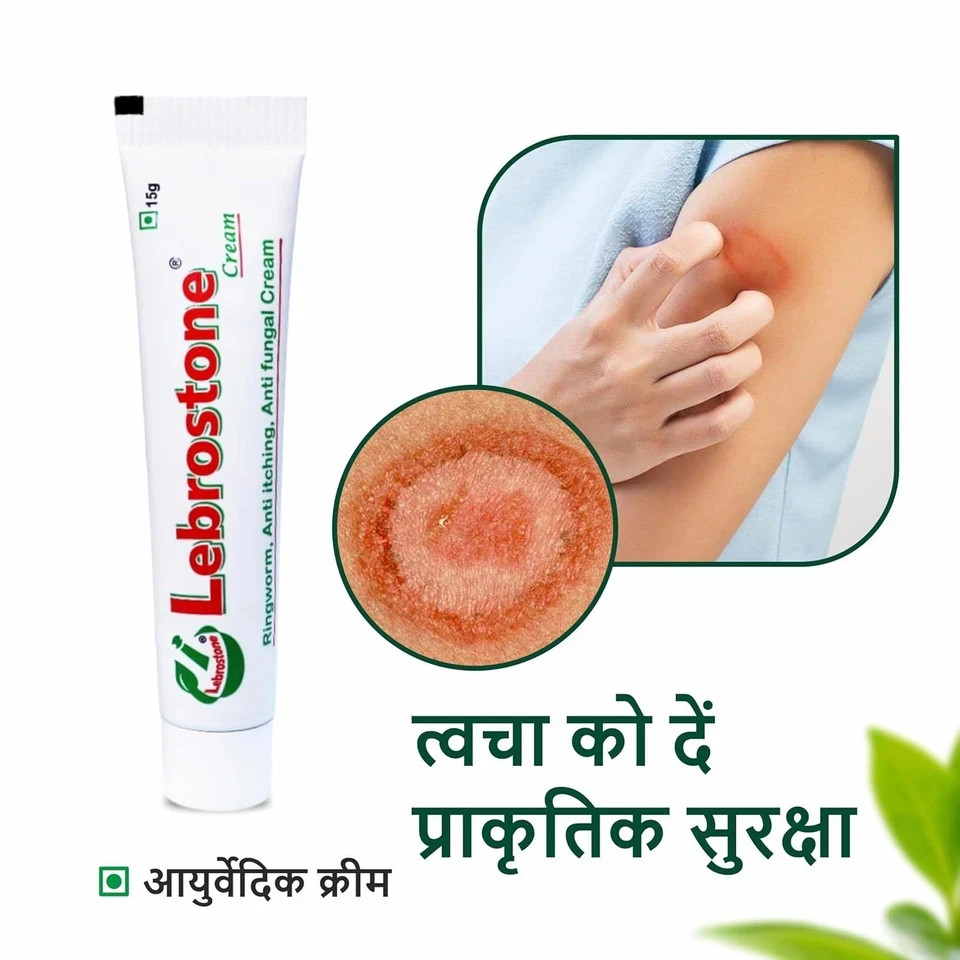 Lebrostone Cream Treatment for Ringworm Anty Itching & Anty Fungal Infections