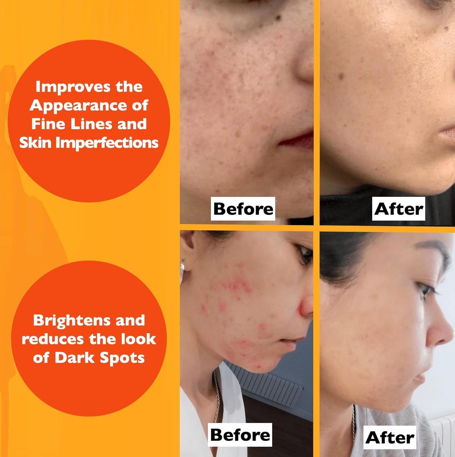 Vitamin C Serum For Face – Anti Aging Face Serum with Vitamin C, Hyaluronic Acid