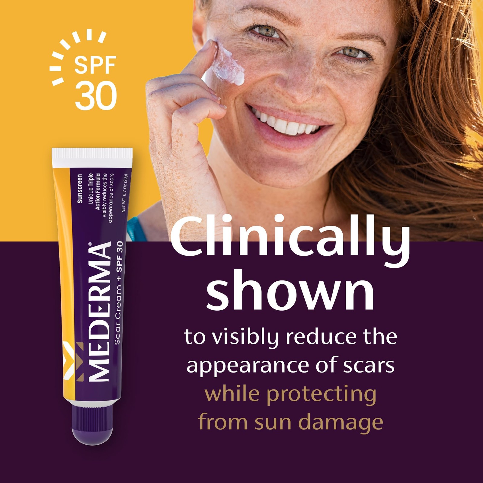 Mederma Scar Cream Plus SPF 30 – 0.7 Ounce (Pack of 1), NOT_APPLICABLE