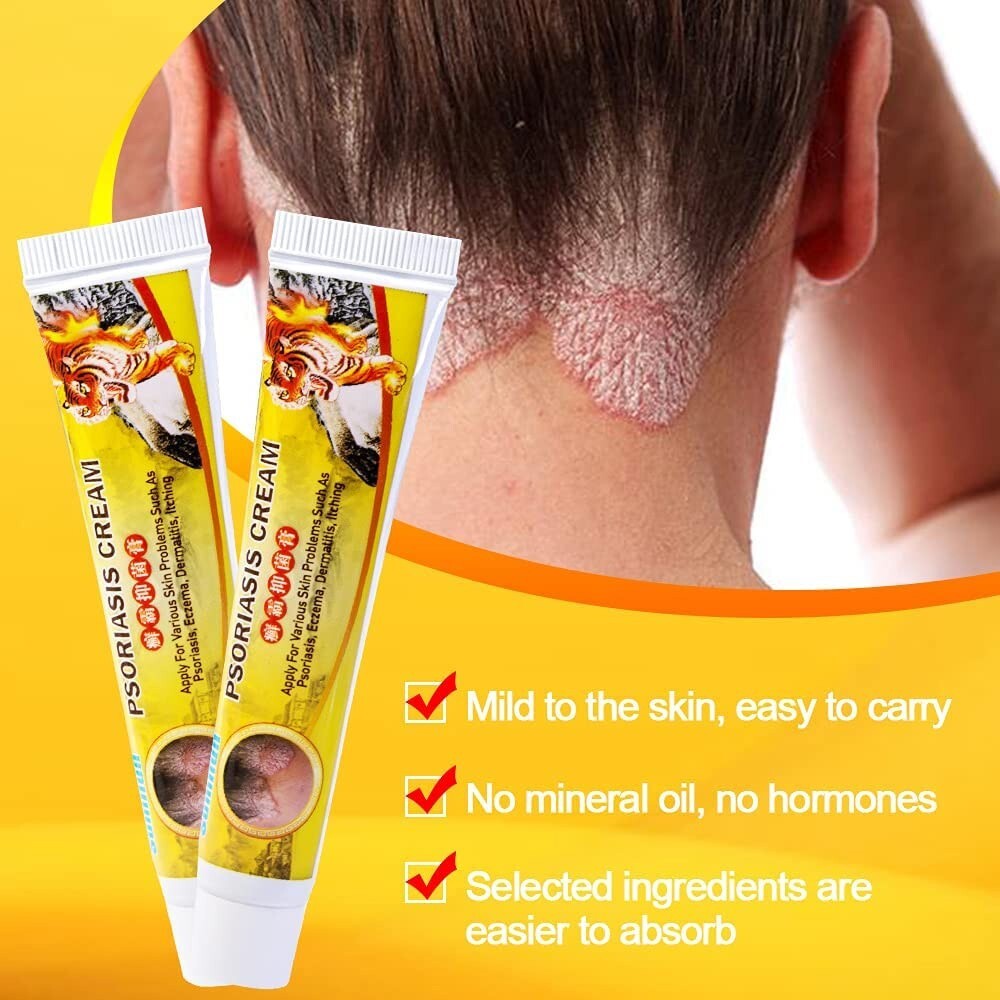 Health Care Psoriasis Cream Eczema Ointment Scalp Psoriasis Hand Tinea Foot 20g