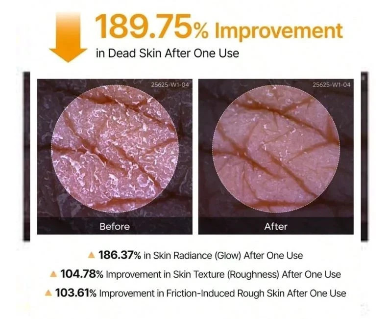 Dr. Melaxin Peel Shot Exfoliant Kojic Acid Turmeric Spray 200ml Brand new–