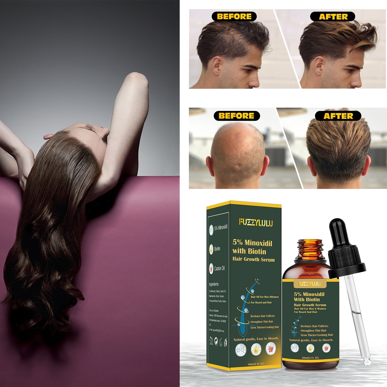 60ML 5% Minoxidil Hair Growth Oil, Hair Serum for Healthier Thicker Hair