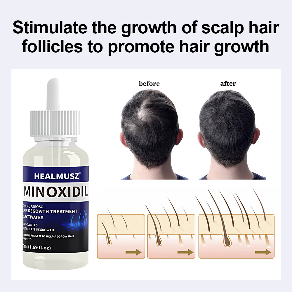 6Pack Minoxidil 5% Extra Strength Hair Regrowth Treatment for Men 6 Month Supply
